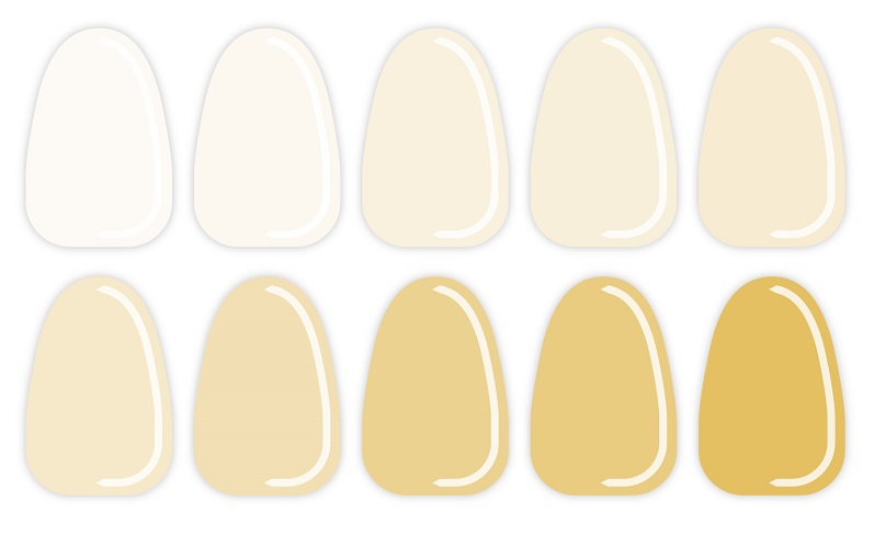 歯の色　カラーチャート