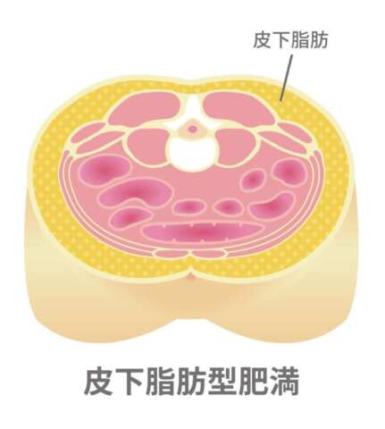 皮下脂肪