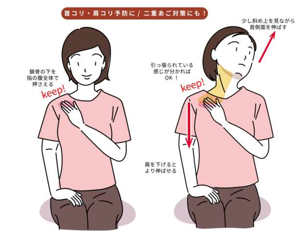 胸鎖乳突筋ストレッチ
